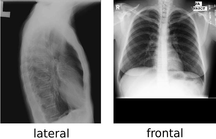 Sample x-rays from the Mongomery dataset