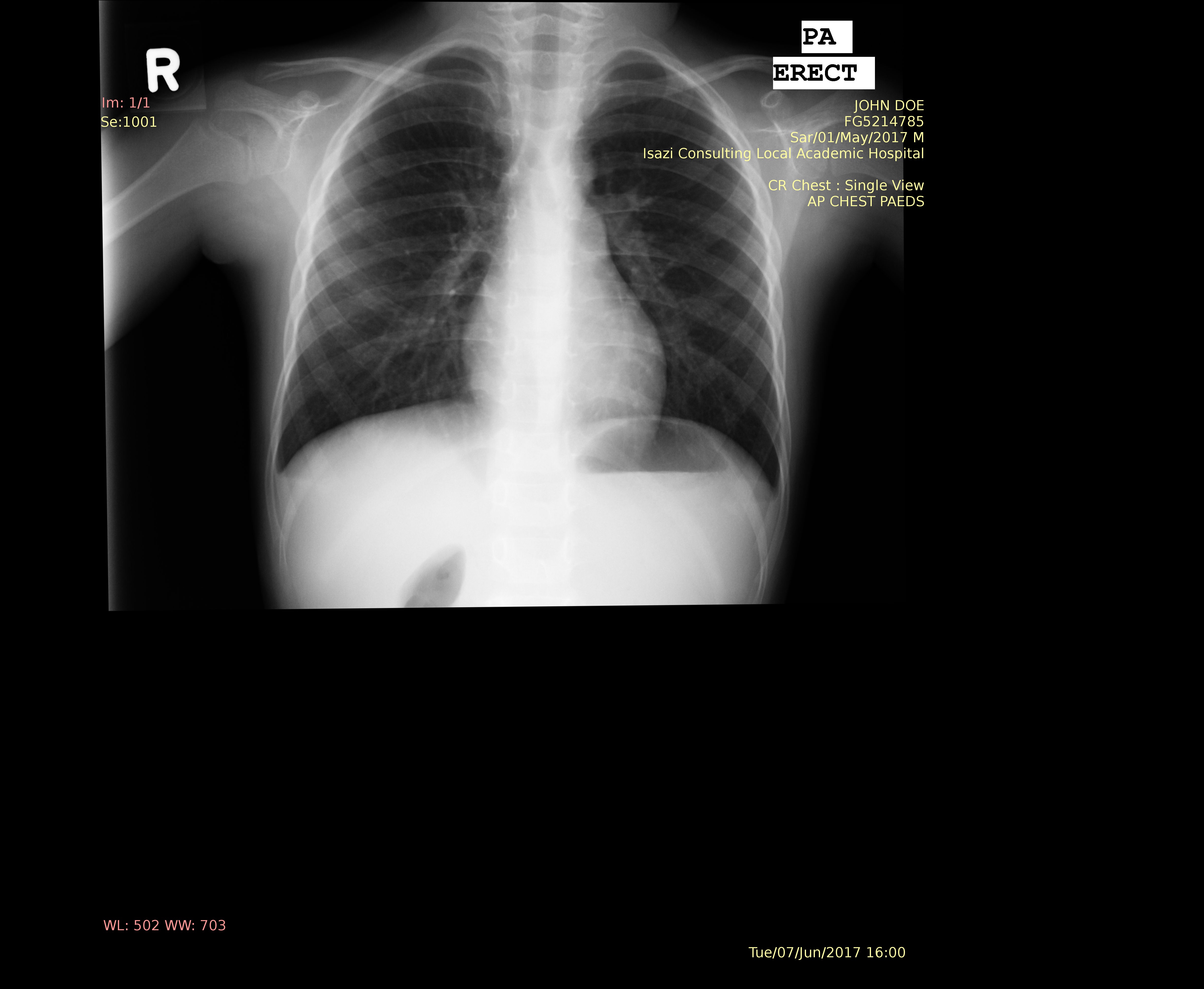 X-Ray containing sensitive information